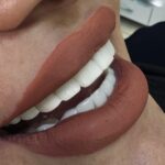 کامپوزیت زیبایی